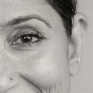 Anti-Aging
