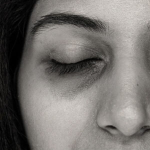 Dark Circles